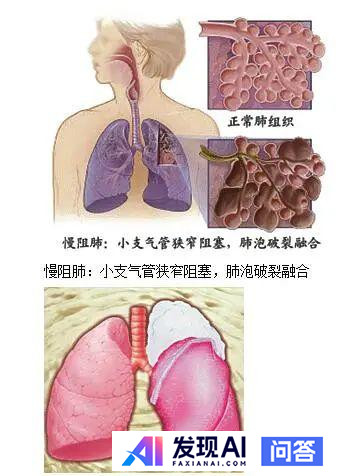 亿万富翁马斯克的生活真的像他前女友说得那么艰苦朴素吗？-4.jpg