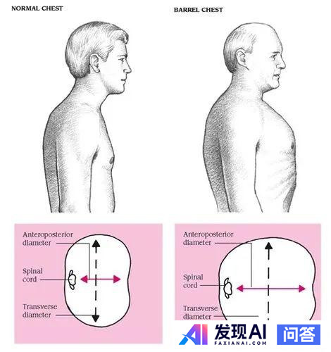 亿万富翁马斯克的生活真的像他前女友说得那么艰苦朴素吗？-2.jpg